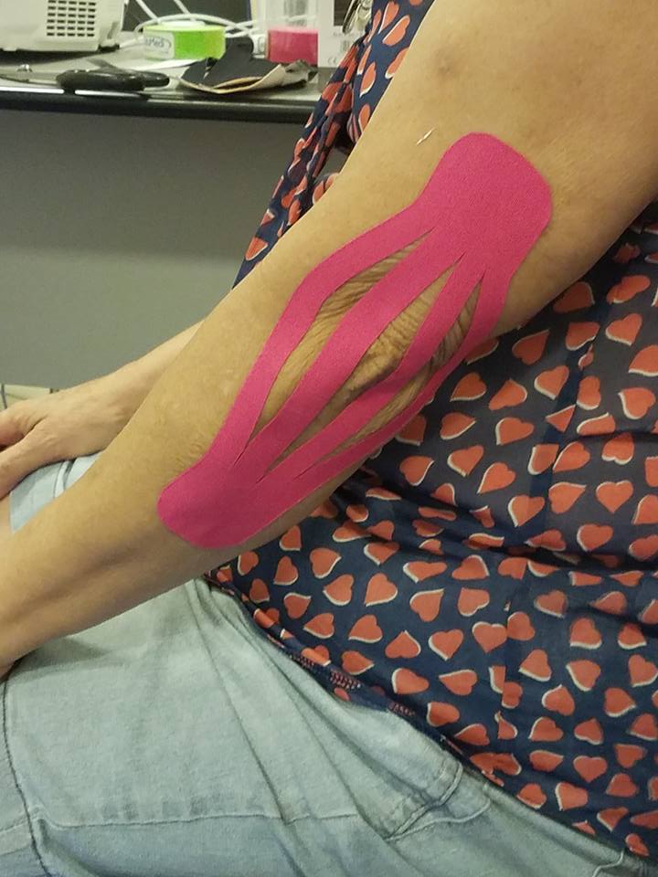 Analgesia em paciente com epicondilite