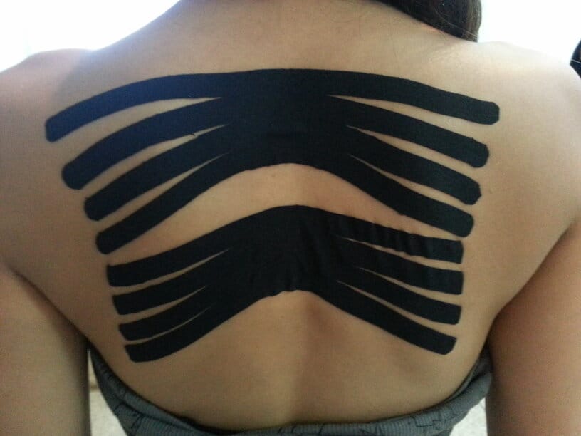 Técnica spider para ativação de romboides e escápulas - Correção postural