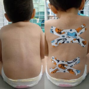 Ativação das estruturas da cadeia posterior para correção postural e controle de tronco