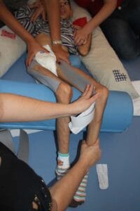 Ativação do adutor da coxa em pct paralisado cerebral