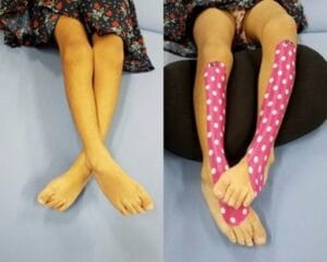 Correção padrão tesoura