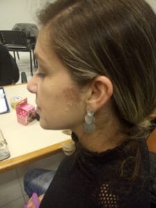 sE VOCÊ SOFRE COM CEFALEIA OU ENXAQUECA, NUNCA MAIS VAI PRECISAR DE REMEDIOS!