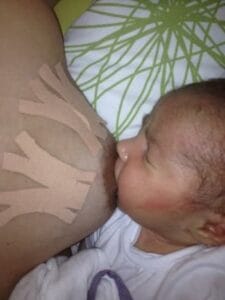 Amamentação e drenagem de colostro