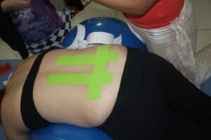 Tecnica para alivio de dor por hernia lombar